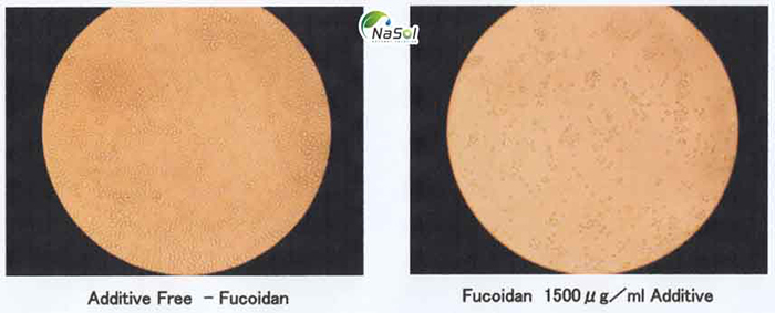 Tác dụng chống ung thư của Fucoidan